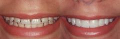 d'ascoli orthodontics reno nv